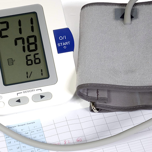 Ein Blutdruckmessgerät mit digitaler Anzeige liegt neben einem Protokollblatt mit aufgezeichneten Werten.