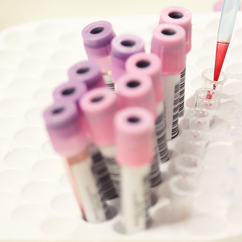 Mehrere vakuumierte Blutprobenröhrchen mit farbigen Kappen stehen in einem Probenständer, während eine Pipette in ein Röhrchen eine flüssige Substanz einfüllt.