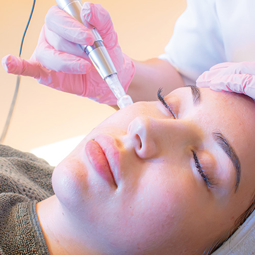 Detailansicht eines Gesichts während einer Microneedling-Behandlung. Eine Kosmetikerin mit rosa Handschuhen führt das silberne Microneedling-Gerät sanft über die Wange der Patientin.